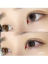 アネラプラス(ANELA Plus+)