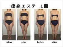 ルナ クレッシェンテ(Luna crescente)/一度で全身のむくみすっきりケア
