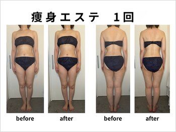 ルナ クレッシェンテ(Luna crescente)/一度で全身のむくみすっきりケア