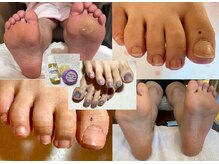 ビサンテ サロンの雰囲気（爪の悩み足の自爪ケア/フットジェルネイル＆角質ケア,人気サロン）