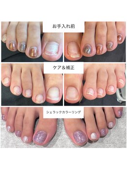 ケアプラス(care plus)/巻爪ケア+カラーリング