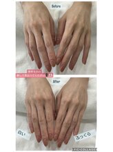 シーオングル(Siii ongle)/泡パック