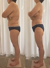 ビンナ 五反田店(Binna)/筋膜リリース１回