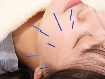 いまはやし鍼灸整体院 香椎和白店の写真/《美容鍼+水素吸引60分¥8,800》美容鍼で肌質改善！年齢とともに気になる毛穴・ホウレイ線・たるみケアに☆