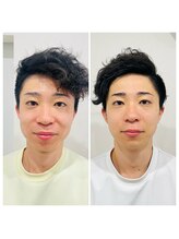 赤沼鍼灸整骨院/美・健康・笑顔に導く美容鍼