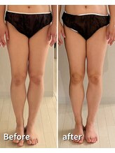 ヒールプラス(heal+)/1ヶ月通っていただきました