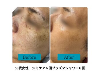 ビジュツ(BIJYUTSU)/