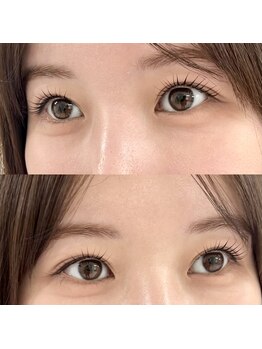 リル 目黒(Rire)/メーテルロッド