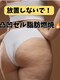 ヨサパーク リノ(YOSA PARK Lino)の写真/セルフケアではなかなか落としずらい！冷えて硬い箇所No.1！頑固な脂肪に集中攻撃！脱下半身太り☆