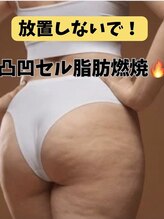 ヨサパーク リノ(YOSA PARK Lino)