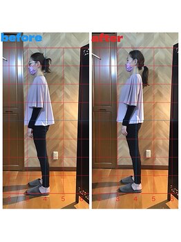 春日部コアラ整体院/Before→After（姿勢）横向き