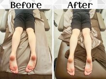 リストアハート(Restore Heart)/骨盤矯正