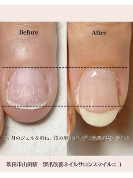 スマイルニコ(smile nico)/ピンクの部分を育成