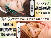 アネモネ 心斎橋院