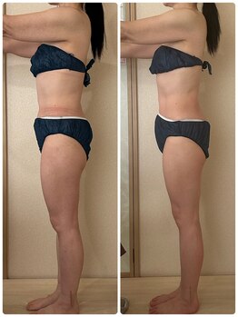 リノ(Lino)/50代/痩身全身5回の変化