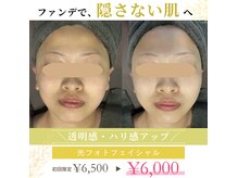 米子美人