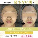 米子美人