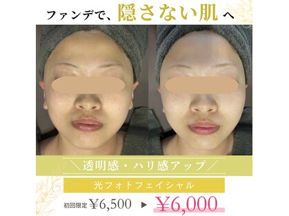 米子美人の写真