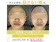 米子美人の写真