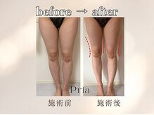 プリア 今治店(Pria)の雰囲気（下半身《むくみスッキリ》痩身エステ）