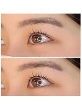 デュレ(durer.)/5）アイブロウ（WAX脱毛）