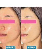 ピュアグレース 自由が丘/エンビロンフル＋光エステ☆