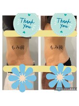 ルナート(Lunart)/腸もみの一回の変化