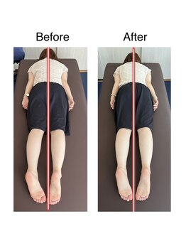 リアン(Liam)/全身ケア整体 before/after