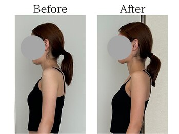 ストーリーバイスター(story by STAR)