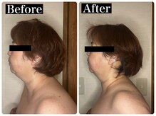 ハーズプラス(hers+)/巻き肩・二重顎の解消☆