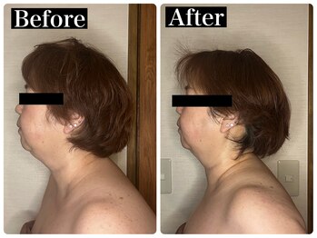 ハーズプラス(hers+)/巻き肩・二重顎の解消☆