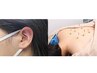 ☆期間限定☆＼春のお悩みに！／耳ツボ＋鍼灸施術　 