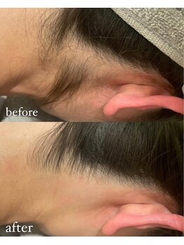 ミリプラス(MiLi +)/うなじ/襟足/産毛