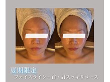 サロン ルポ(Repos)の雰囲気（お客様のご要望からできた【期間限定】フェイシャル付きコース）