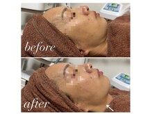 ソレラ(sorelle)/ハイパーナイフ