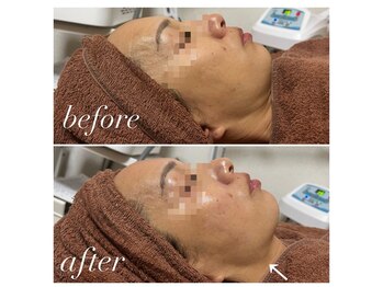 ソレラ(sorelle)/ハイパーナイフ