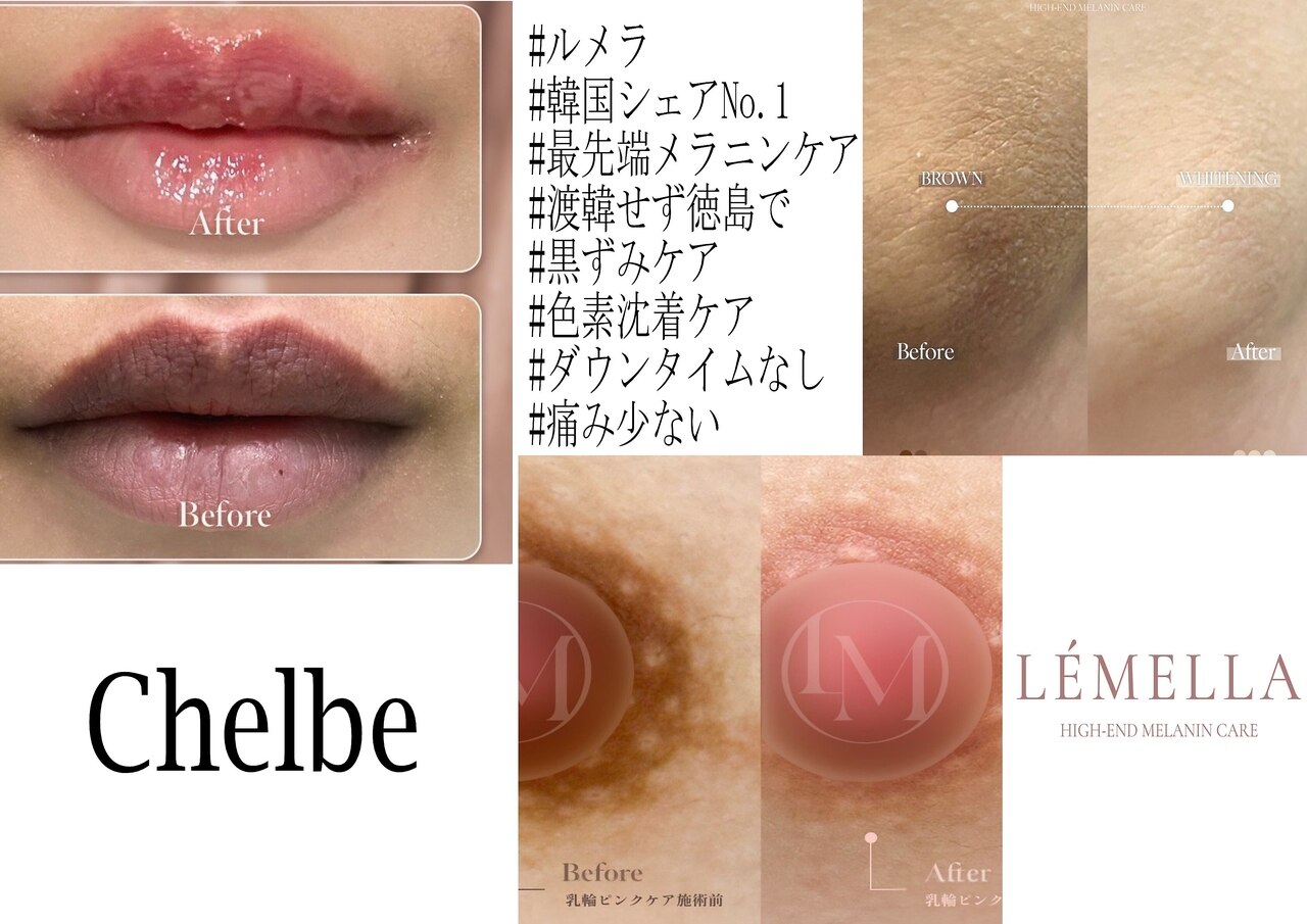 チェルビー(chelbe)｜ホットペッパービューティー
