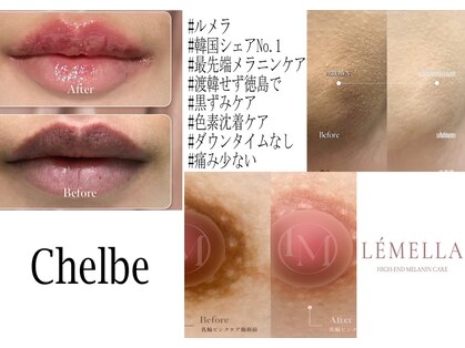 チェルビー(chelbe)の写真