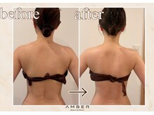 アンバー 恵比寿(AMBER)/肩甲骨から腰、背中全体美しく。
