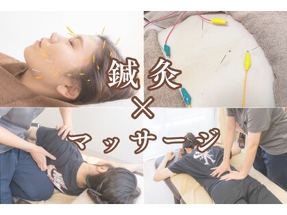 アボット(ABBOTT)の写真