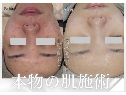 ルミエール パークサイド(L’MIERE parkside)の写真