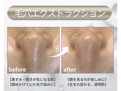 ラグラス(Laglace)の写真