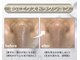 ラグラス(Laglace)の写真