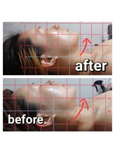 リラージェ 池袋(Relaje)/インディバface＊before→after