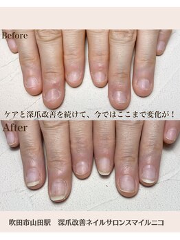 ピンクの部分育成