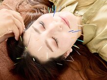 鍼灸ハリカラの雰囲気（【小顔・肌質・たるみ・シミに】美容鍼灸×矯正×フェイシャル◎）