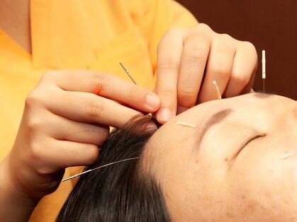 さらのて鍼灸院の写真