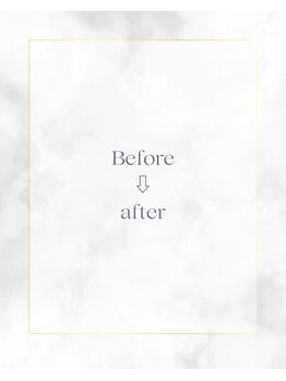 ニューユー(NewYou)/Before after