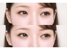 ホワイトアイ 表参道(WHITE EYE)/ラッシュリフト