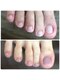 ブルームーンネイルズ(BLOOMOON.nails)の写真/【フットの深爪のお悩みに。その日のうちに見た目の変化を実感◎サンダルも楽しめる足元へ】